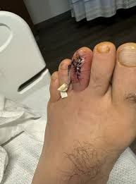 muhammad toe
