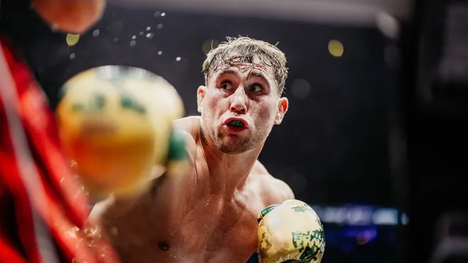 Close-up of a shirtless male boxer with yellow gloves in a match, looking up with a focused, surprised expression.