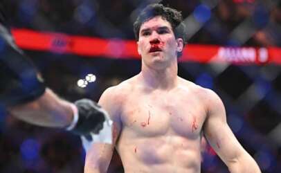 Male MMA fighter with a bloody nose, shirtless, standing in the cage after a match.
