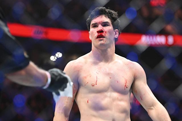Male MMA fighter with a bloody nose, shirtless, standing in the cage after a match.