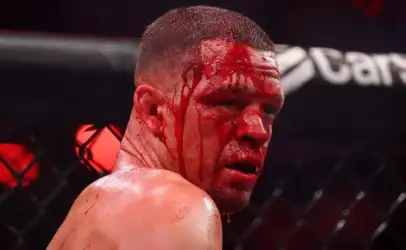 Bloodied male MMA fighter in a cage, looking over his shoulder during a bout sequence.