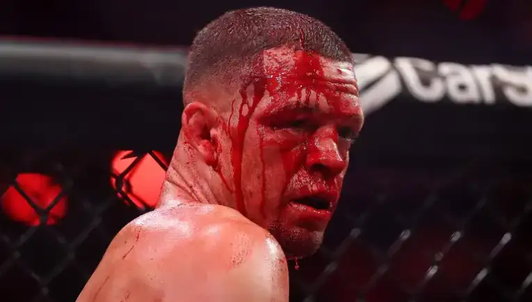 Bloodied male MMA fighter in a cage, looking over his shoulder during a bout sequence.