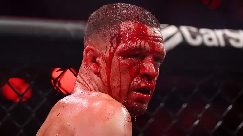 GettyImages-2276637301-e1779024618161 - AfroCombat Bloodied male MMA fighter in a cage, looking over his shoulder during a bout sequence.
