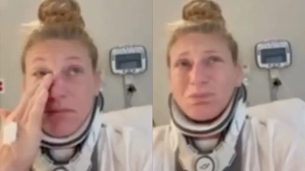 Two side-by-side images of a female medical professional in a striped gown with a stethoscope, touching her eye in the left frame and looking ahead in the right frame, medical monitor on the wall behind her.